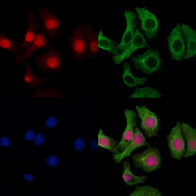 SPIC Antibody in Immunocytochemistry (ICC/IF)