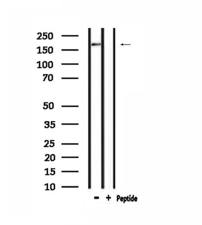 ARID1B Antibody in Western Blot (WB)