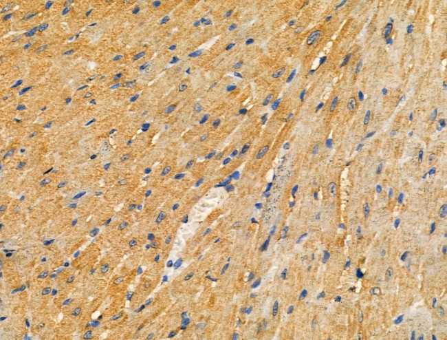 PARD3 Antibody in Immunohistochemistry (Paraffin) (IHC (P))