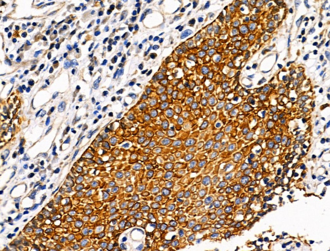 ATF6-beta Antibody in Immunohistochemistry (Paraffin) (IHC (P))