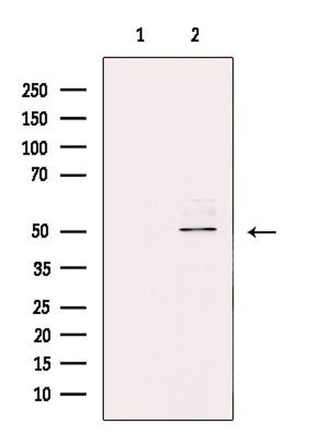 ZNF436 Antibody in Western Blot (WB)