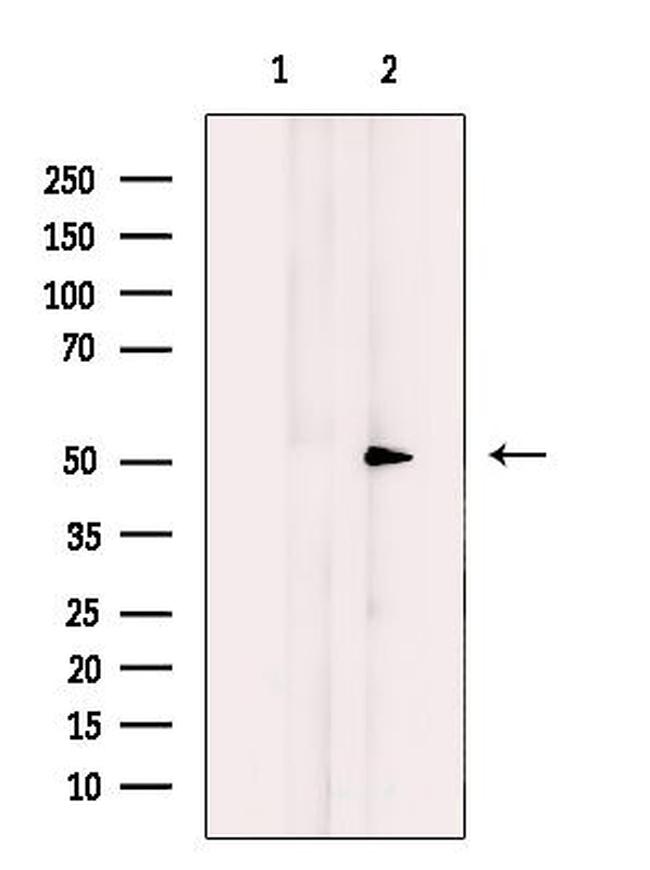 MUC13 Antibody in Western Blot (WB)
