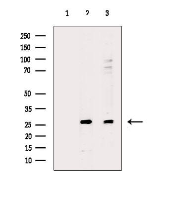 AKIP1 Antibody in Western Blot (WB)