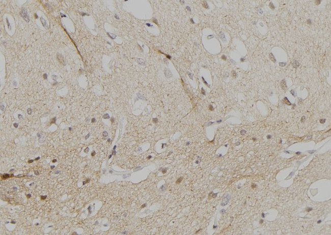 FOXD3 Antibody in Immunohistochemistry (Paraffin) (IHC (P))