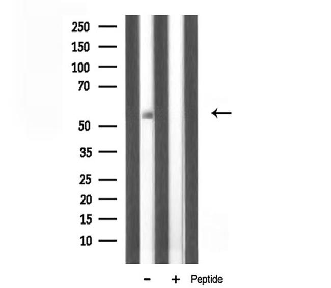 TBX22 Antibody in Western Blot (WB)