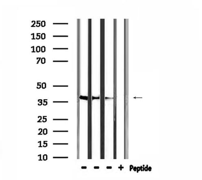 HTR1F Antibody in Western Blot (WB)