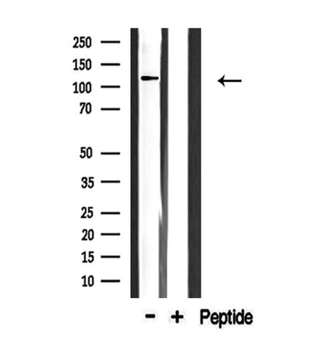 COL1A2 Antibody in Western Blot (WB)