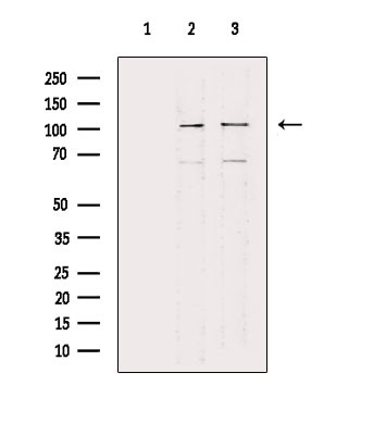 COL6A2 Antibody in Western Blot (WB)