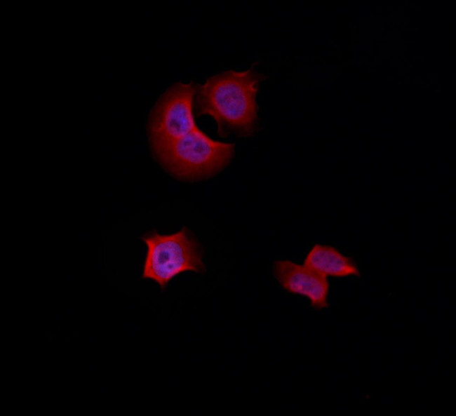 HSPB2 Antibody in Immunocytochemistry (ICC/IF)