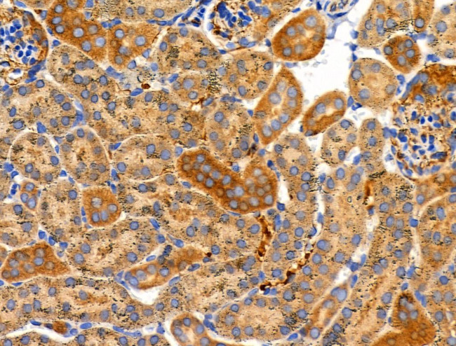 MRPL15 Antibody in Immunohistochemistry (Paraffin) (IHC (P))