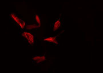 RPS4X Antibody in Immunocytochemistry (ICC/IF)