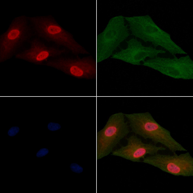 RPL15 Antibody in Immunocytochemistry (ICC/IF)