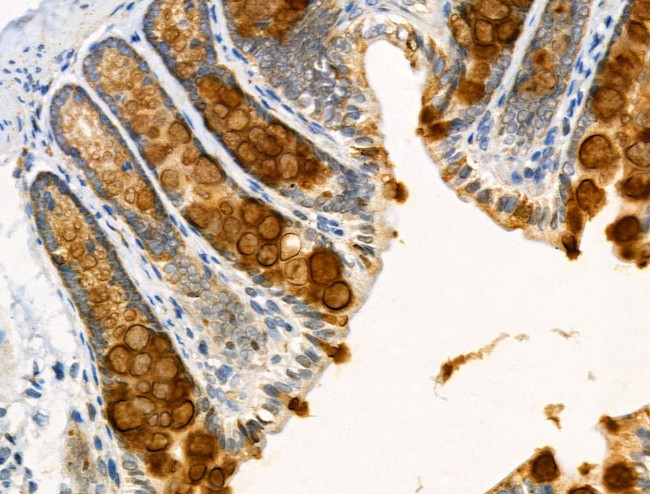 ACSS2 Antibody in Immunohistochemistry (Paraffin) (IHC (P))