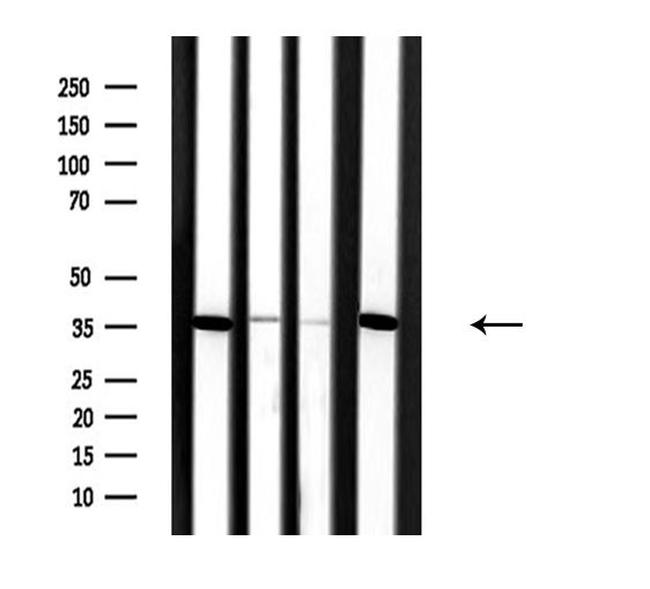 SLC25A31 Antibody in Western Blot (WB)