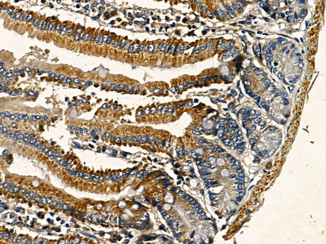 ARFGAP3 Antibody in Immunohistochemistry (Paraffin) (IHC (P))