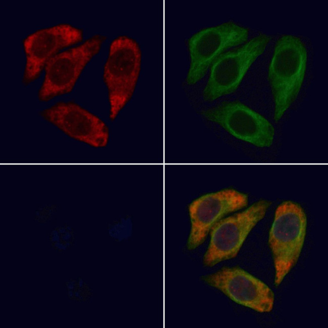 Alpha Sarcoglycan Antibody in Immunocytochemistry (ICC/IF)
