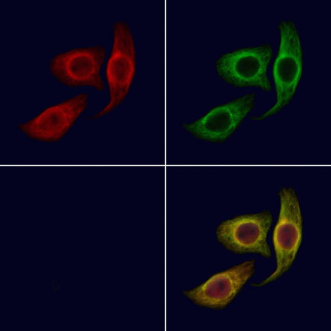 PAT1 Antibody in Immunocytochemistry (ICC/IF)