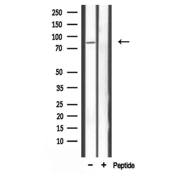 CARF Antibody in Western Blot (WB)