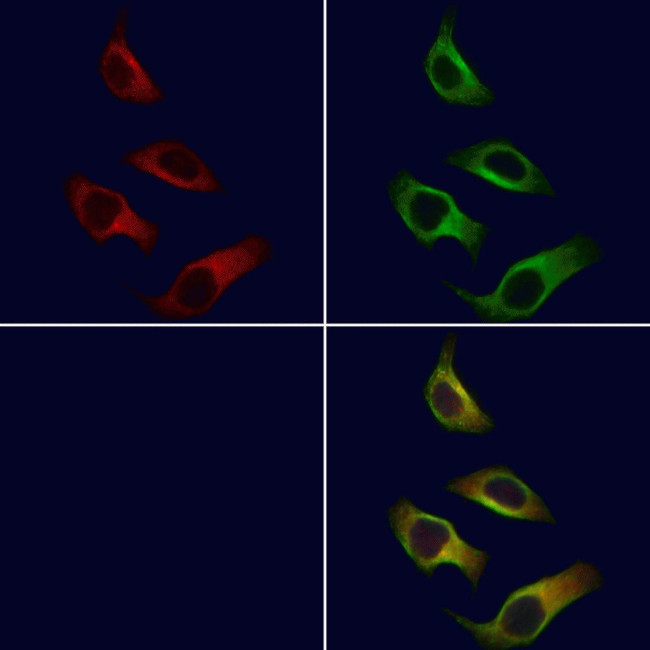 ARMC6 Antibody in Immunocytochemistry (ICC/IF)