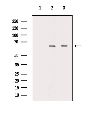 ARSI Antibody in Western Blot (WB)