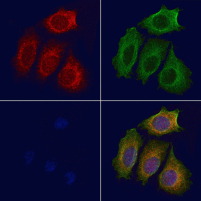 PDE4C Antibody in Immunocytochemistry (ICC/IF)