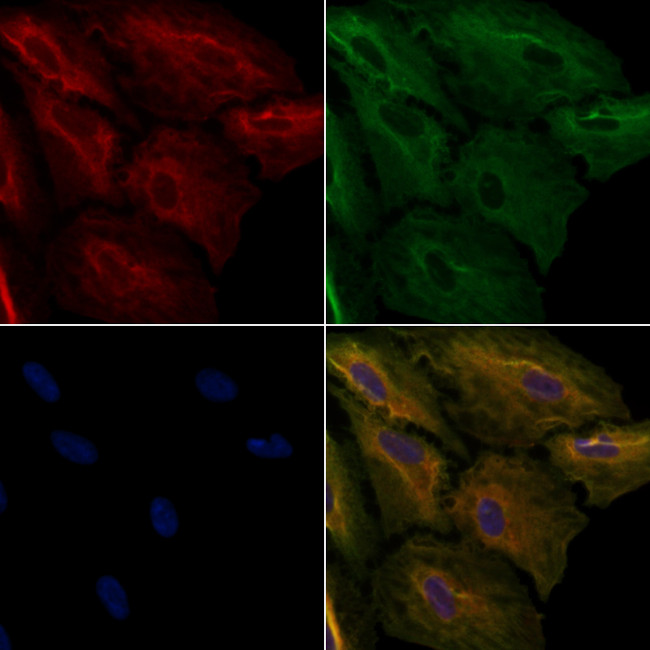 CAGE1 Antibody in Immunocytochemistry (ICC/IF)