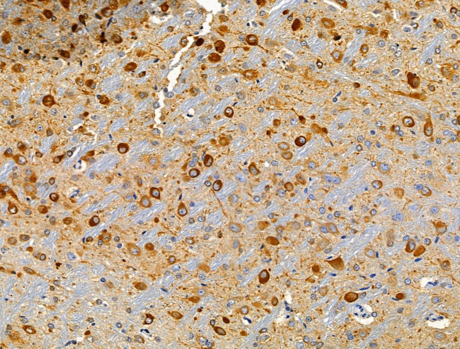 CLIP4 Antibody in Immunohistochemistry (Paraffin) (IHC (P))