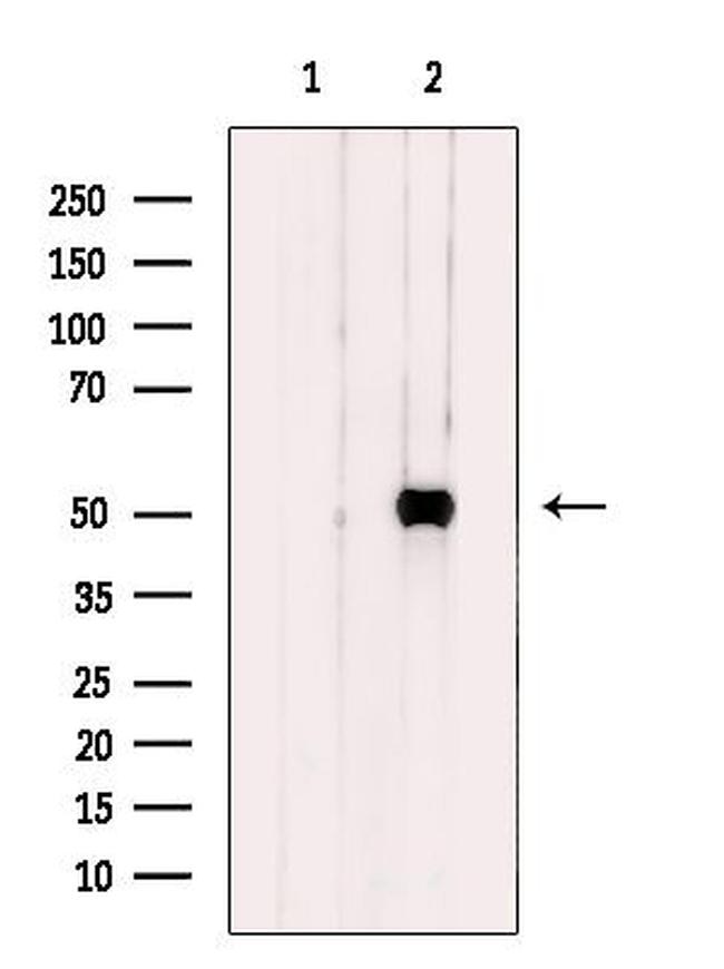 Carboxypeptidase A5 Antibody in Western Blot (WB)