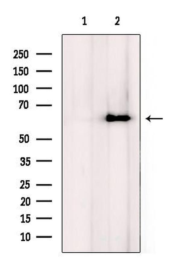 CPN2 Antibody in Western Blot (WB)
