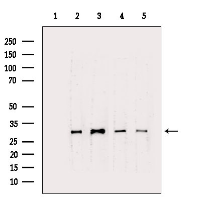 CTDSP1 Antibody in Western Blot (WB)