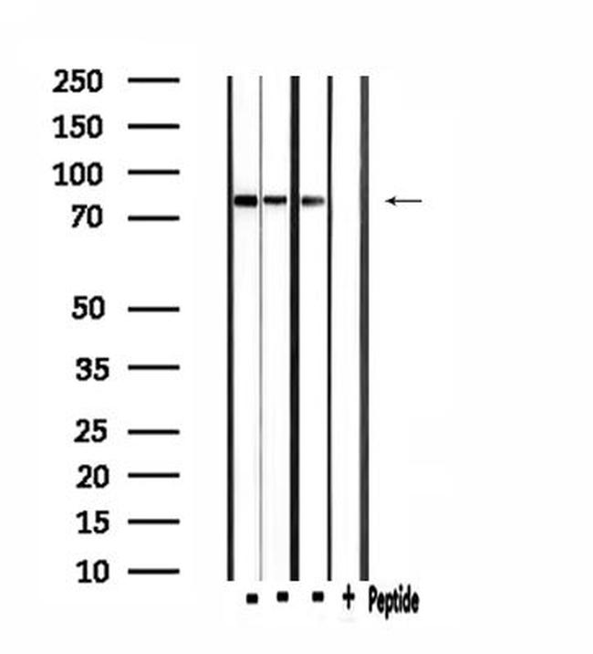 CLCN4 Antibody in Western Blot (WB)