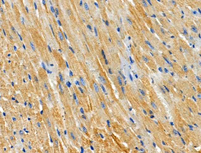 CHSY1 Antibody in Immunohistochemistry (Paraffin) (IHC (P))