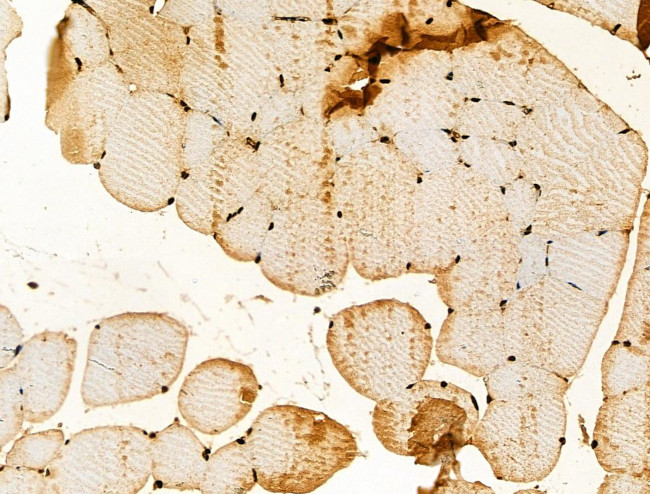 RFWD2 Antibody in Immunohistochemistry (Paraffin) (IHC (P))