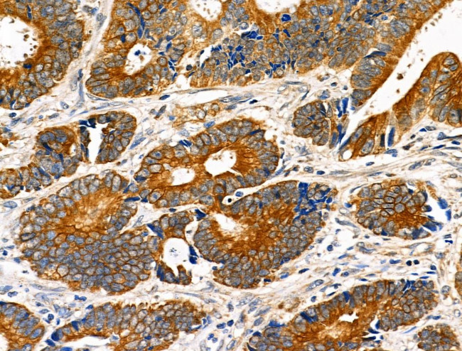 eIF5B Antibody in Immunohistochemistry (Paraffin) (IHC (P))