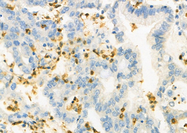 FOXD4 Antibody in Immunohistochemistry (Paraffin) (IHC (P))