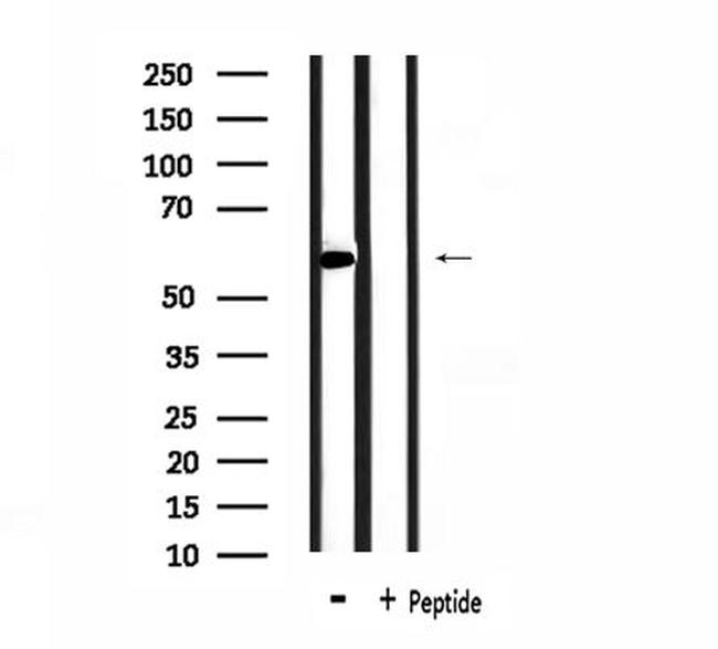 hnRNP LL Antibody in Western Blot (WB)