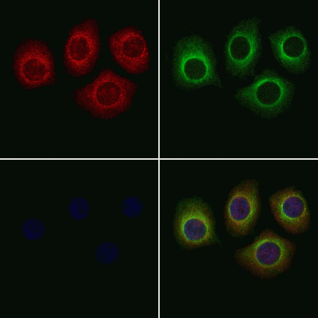 MBL2 Antibody in Immunocytochemistry (ICC/IF)