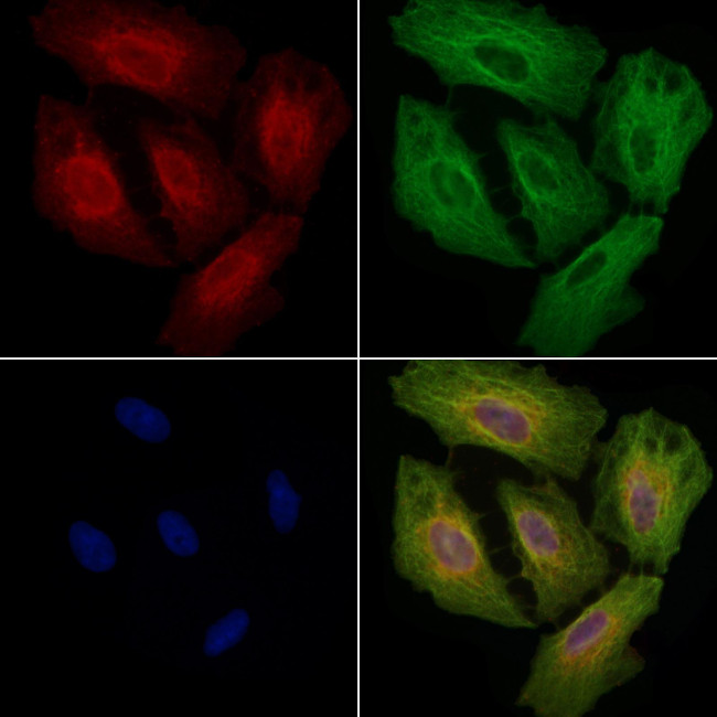MRPL3 Antibody in Immunocytochemistry (ICC/IF)