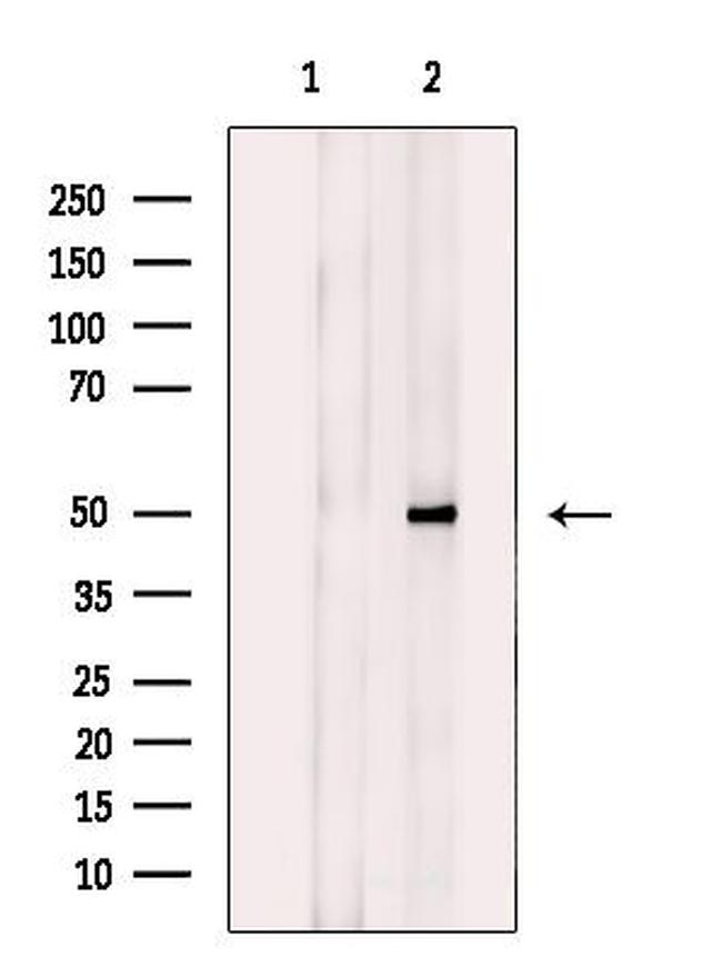 SLC16A14 Antibody in Western Blot (WB)