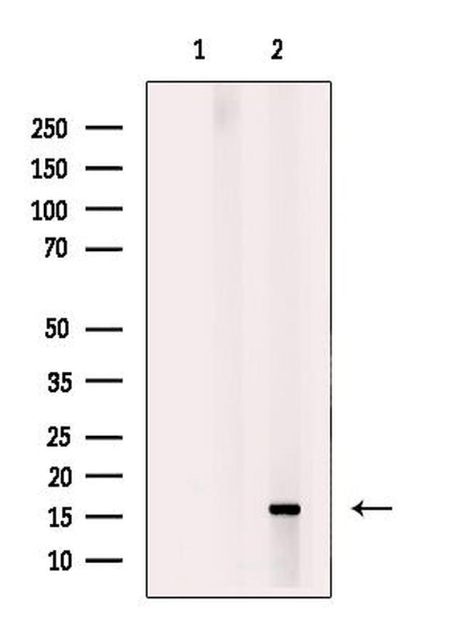 Myoglobin Antibody in Western Blot (WB)