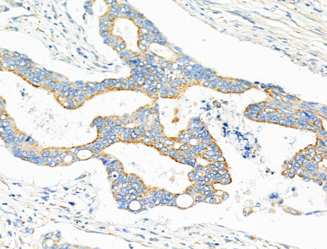 NDUFV2 Antibody in Immunohistochemistry (Paraffin) (IHC (P))