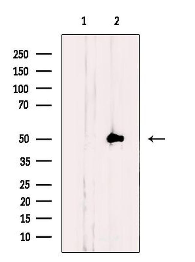 NLE1 Antibody in Western Blot (WB)