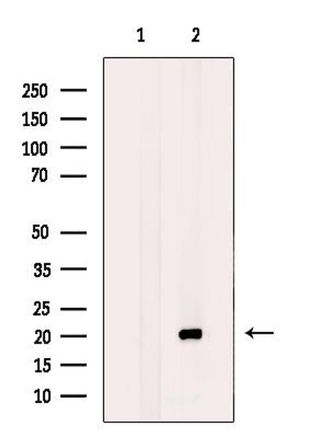 BTC Antibody in Western Blot (WB)