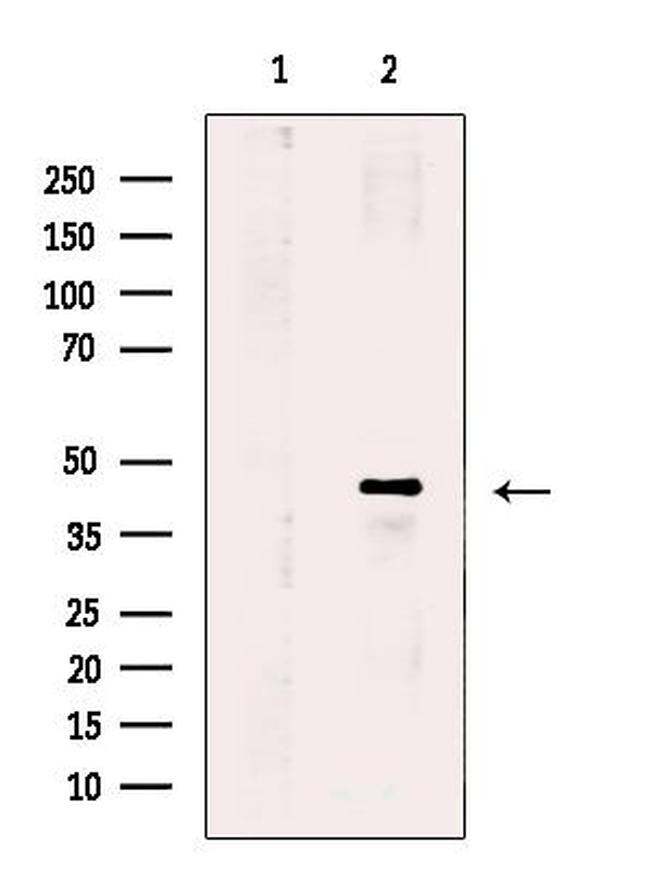 PPM1L Antibody in Western Blot (WB)
