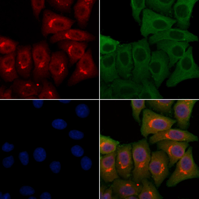 PMS2/PMS2CL Antibody in Immunocytochemistry (ICC/IF)