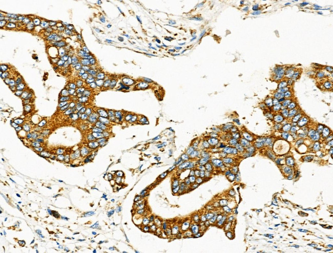 MOV10L1 Antibody in Immunohistochemistry (Paraffin) (IHC (P))
