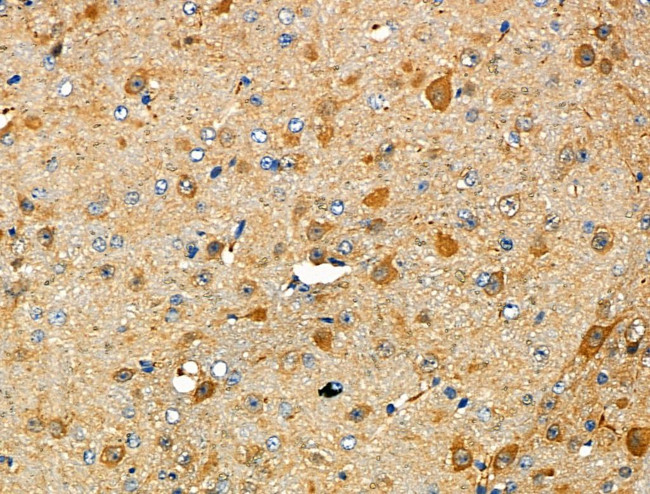 RAP1GAP Antibody in Immunohistochemistry (Paraffin) (IHC (P))