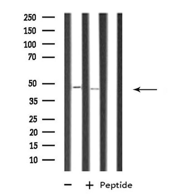 RRAGB Antibody in Western Blot (WB)