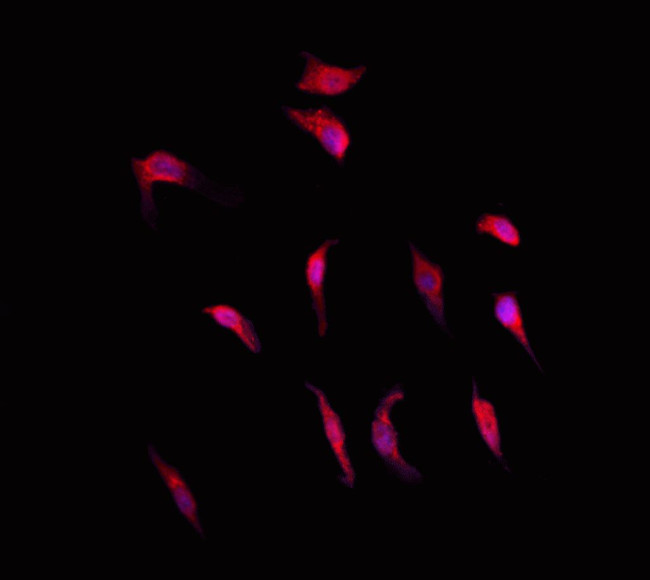 RGS10 Antibody in Immunocytochemistry (ICC/IF)