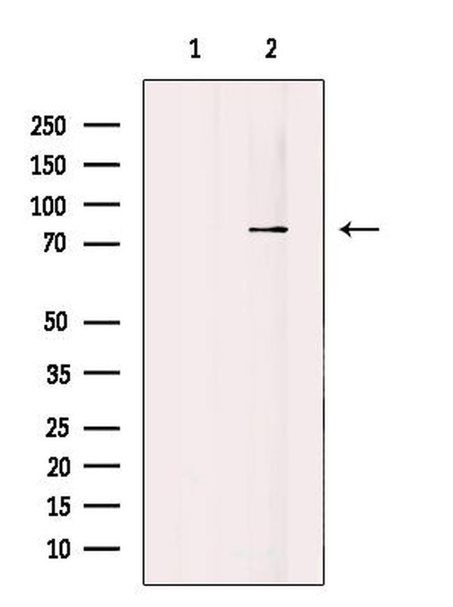 ARHGEF16 Antibody in Western Blot (WB)